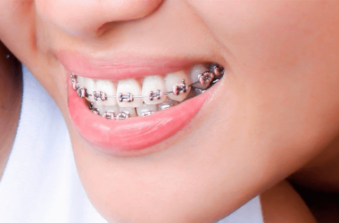 Consultório odontológico conta agora com ortodontia